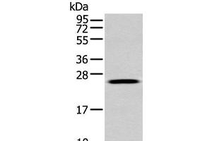 Western blot analysis of A549 cell using FGFBP1 Polyclonal Antibody at dilution of 1:350 (FGFBP1 Antikörper)