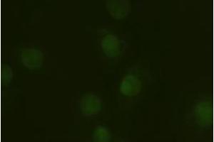 Immunofluorescent staining of HeLa cells using anti-A1AT mouse monoclonal antibody (ABIN2452352). (SERPINA1 Antikörper  (AA 26-418))