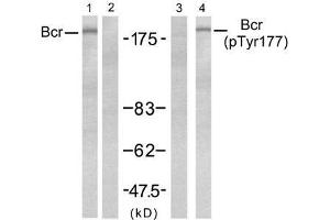 Western blot analysis of extract from A431 ce lls, untreated or treated with EGF (200ng/ml, 5min), using Bcr (Ab-177) antibody (E021197, Lane 1 and 2) and Bcr(phospho-Tyr177) antibody (E011199, Lane 3 and 4). (BCR Antikörper  (pTyr177))