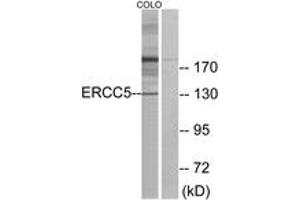 Western blot analysis of extracts from COLO cells, using ERCC5 Antibody. (ERCC5 Antikörper  (AA 131-180))