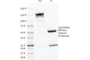 SDS-PAGE Analysis Purified PTH Mouse Monoclonal Antibody (PTH/1175). (PTH Antikörper  (AA 32-115))
