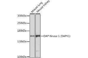 Western blot analysis of extracts of various cell lines, using DAP Kinase 1 (DAP Kinase 1 (D)) Antibody (ABIN6130240, ABIN6139401, ABIN6139402 and ABIN6221411) at 1:1000 dilution. (DAP Kinase 1 Antikörper  (AA 1141-1430))