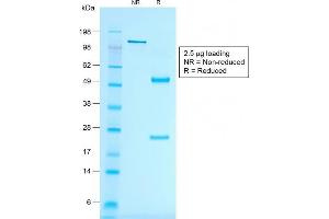 SDS-PAGE Analysis of Purified MART-1 Mouse Recombinant Monoclonal Antibody (rMLANA/788). (Rekombinanter MLANA Antikörper)