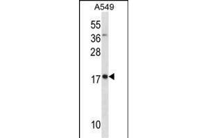 MYL4 Antikörper  (N-Term)