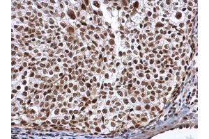 Immunohistochemistry (IHC) image for anti-THO Complex 4 (THOC4) antibody (ABIN2856936)