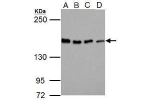 Western Blotting (WB) image for anti-Bloom Syndrome RecQ Like Helicase (BLM) (C-Term) antibody (ABIN2855003)