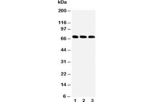 Western blot testing of IRAKM antibody and Lane 1:  HeLa;  2: Jurkat;  3: HUT102 cell lysate
