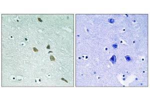 Immunohistochemistry (IHC) image for anti-Integrin-Linked Kinase (ILK) (Ser246) antibody (ABIN1848218)