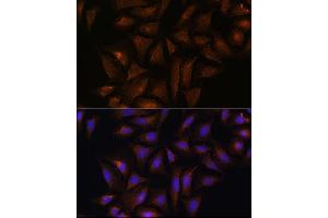 Immunofluorescence analysis of U-2 OS cells using CRYZ Rabbit pAb  at dilution of 1:100 (40x lens).