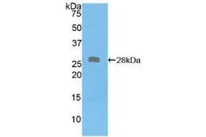 Detection of Recombinant PKD2, Human using Polyclonal Antibody to Protein Kinase D2 (PKD2) (PKD2 Antikörper  (AA 621-832))