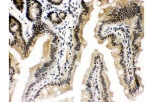IHC testing of FFPE mouse intestine with CTCF antibody. (CTCF Antikörper  (AA 521-727))