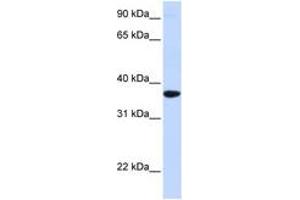 Image no. 1 for anti-Secretagogin, EF-Hand Calcium Binding Protein (SCGN) (AA 180-229) antibody (ABIN6743096) (SCGN Antikörper  (AA 180-229))