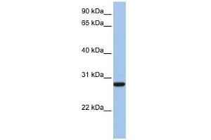 VDAC3 antibody used at 1 ug/ml to detect target protein. (VDAC3 Antikörper  (N-Term))
