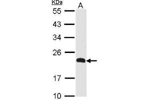 WB Image Sample (30 ug of whole cell lysate) A: Raji 12% SDS PAGE CKLFSF5 antibody antibody diluted at 1:500 (CMTM5 Antikörper  (N-Term))