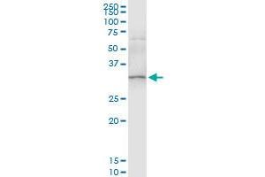 Immunoprecipitation (IP) image for anti-Sulfotransferase Family, Cytosolic, 1A, Phenol-Preferring, Member 1 (SULT1A1) (AA 1-295) antibody (ABIN520601)