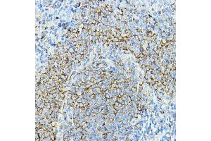 Immunohistochemistry of paraffin-embedded mouse spleen using CD79a Rabbit pAb (ABIN1679100, ABIN3015116, ABIN3015118 and ABIN6213808) at dilution of 1:100 (40x lens).