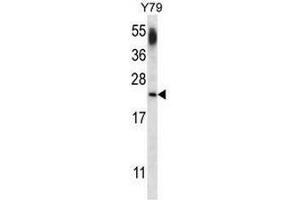 CNRP1 Antibody (Center) western blot analysis in Y79 cell line lysates (35µg/lane). (Cnrip1 Antikörper  (Middle Region))