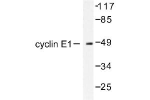 Image no. 1 for anti-Cyclin E1 (CCNE1) antibody (ABIN265379)