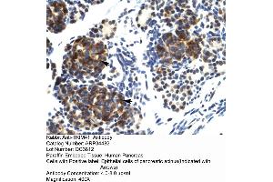 Human Pancreas (TRIM41 Antikörper  (C-Term))