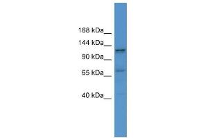 WB Suggested Anti-ERC1 Antibody Titration: 0. (ERC1 Antikörper  (C-Term))