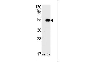 Western Blotting (WB) image for anti-Tumor Protein P53 (TP53) (AA 1-30) antibody (ABIN390201)