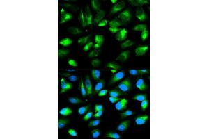 Immunofluorescence analysis of HeLa cells using ARHGDIA antibody. (ARHGDIA Antikörper  (AA 1-204))