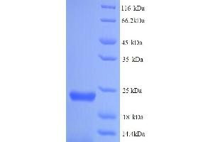 SDS-PAGE (SDS) image for Gen Endonuclease Homolog 1 (GEN1) (AA 1-183), (full length) protein (His tag) (ABIN5713720)