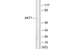 Western blot analysis of extracts from NIH/3T3cells, treated with PDGF (50 mg /mL, 20 mins), using Akt (Ab-124) antibody. (AKT1 Antikörper  (Ser124))