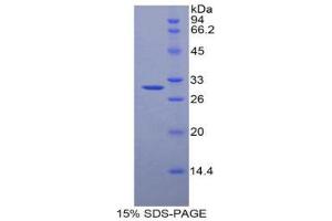 SDS-PAGE (SDS) image for alpha-2-Macroglobulin (A2M) (AA 1097-1357) protein (His tag,GST tag) (ABIN2120529)