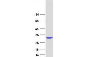 Western Blotting (WB) image for Glutathione S-Transferase alpha 3 (GSTA3) protein (Myc-DYKDDDDK Tag) (ABIN2722270)