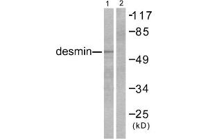 Western blot analysis of extracts from K562 cells, using Desmin antibody. (Desmin Antikörper  (C-Term))