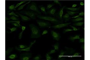 Immunofluorescence of monoclonal antibody to IL15 on HeLa cell. (IL-15 Antikörper  (AA 49-162))
