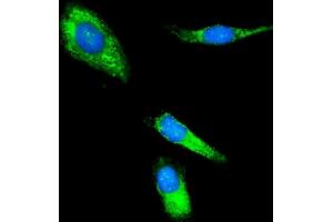 IF analysis of CLPP using anti-CLPP antibody (ABIN7602061).