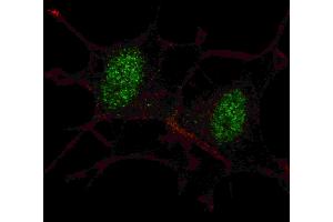 Fluorescent confocal ige of SY5Y cells stained with SD2 antibody. (SMAD2 Antikörper  (AA 97-125))