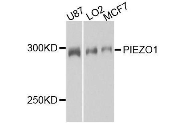 PIEZO1 Antikörper  (AA 2230-2420)