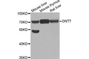 Western Blotting (WB) image for anti-Deoxynucleotidyltransferase, terminal (DNTT) antibody (ABIN1882380) (TdT Antikörper)