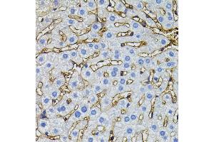 Immunohistochemistry of paraffin-embedded mouse liver using CBL antibody (ABIN5995395) (40x lens). (CBL Antikörper)
