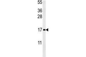CCL4 antibody western blot analysis in mouse bladder tissue lysate (15ug/lane). (CCL4 Antikörper  (AA 22-48))