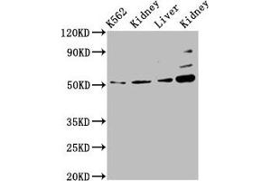Western Blot Positive WB detected in: K562 whole cell lysate, Rat kidney tissue, Mouse liver tissue, Mouse kidney tissue All lanes: GSS antibody at 5. (Glutathione Synthetase Antikörper  (AA 290-418))