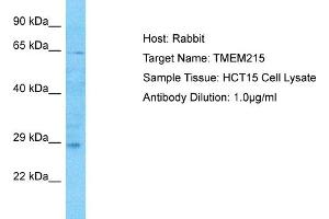 Host: Rabbit Target Name: TMEM215 Sample Type: HCT15 Whole Cell lysates Antibody Dilution: 1. (TMEM215 Antikörper  (N-Term))