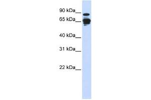 Amphiphysin antibody used at 1 ug/ml to detect target protein. (Amphiphysin Antikörper  (N-Term))