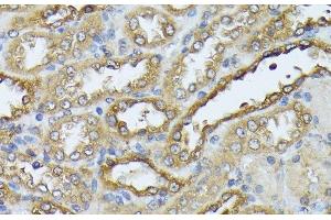 Immunohistochemistry of paraffin-embedded Rat kidney using DAPK3 Polyclonal Antibody at dilution of 1:100 (40x lens). (DAPK3 Antikörper)