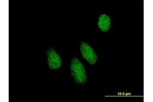 Immunofluorescence of purified MaxPab antibody to NUPL1 on HeLa cell. (NUPL1 Antikörper  (AA 1-599))