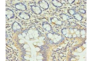 Immunohistochemistry of paraffin-embedded human small intestine tissue using ABIN7148128 at dilution of 1:100 (CCDC57 Antikörper  (AA 1-300))