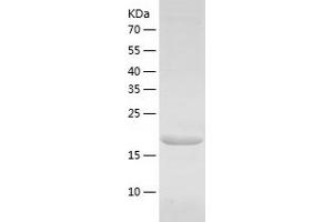Western Blotting (WB) image for Dihydrofolate Reductase (DHFR) (AA 1-187) protein (His tag) (ABIN7122665)