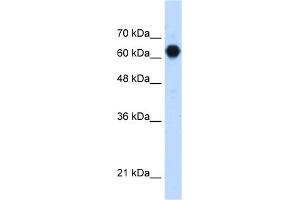 WB Suggested Anti-C3orf39 Antibody Titration:  1. (C3orf39 Antikörper  (Middle Region))