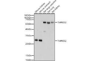 TMPRSS2 anticorps  (AA 140-400)