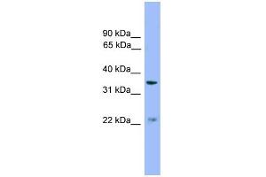 WB Suggested Anti-ZDHHC21 Antibody Titration: 0. (ZDHHC21 Antikörper  (Middle Region))
