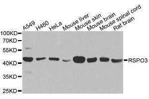 Western blot analysis of extracts of various cell lines, using RSPO3 antibody. (R-Spondin 3 Antikörper  (AA 1-100))