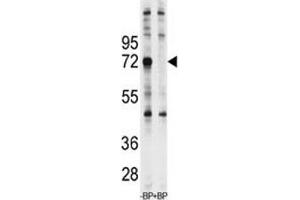 Western blot analysis of Ubiquilin-1 antibody pre-incubated with and without blocking peptide in Jurkat lysate